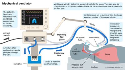 Mechanical ventilation