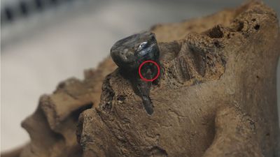 Denisovan tooth