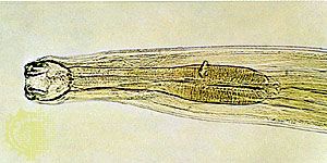 hookworm